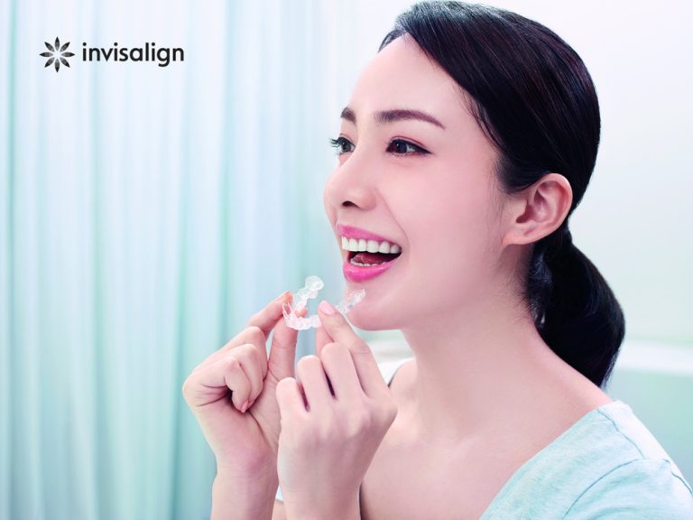 インビザラインInvisalign